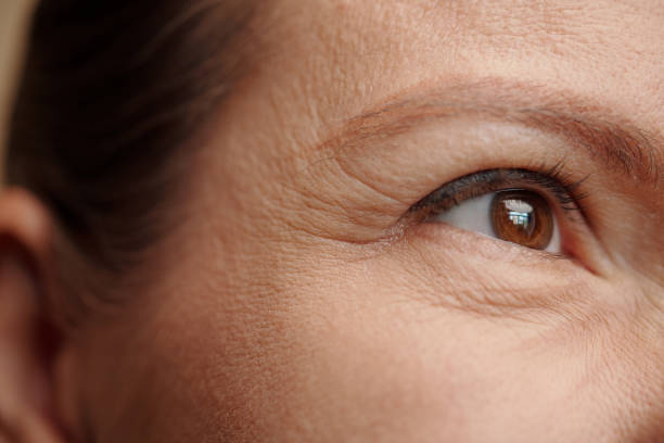 Rughe degli occhi di donna di mezza età, cura della pelle e concetto di terapia ringiovanente